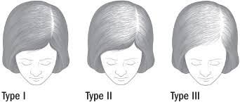 Traction hair loss (traction alopecia). Treating Female Pattern Hair Loss Harvard Health
