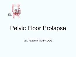 ppt pelvic floor prolapse powerpoint