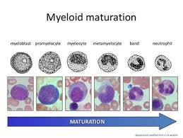 Myelocyte Metamyelocyte Google Medical Laboratory