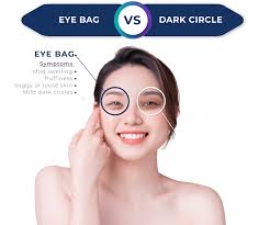 dark circle eye bag ko skin specialist