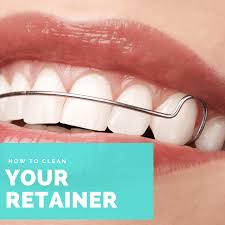 Place the retainer into the solution and soak for at least 5 minutes. How To Clean Your Retainer