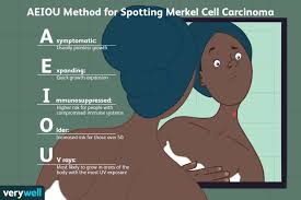 how merkel cell carcinoma is diagnosed