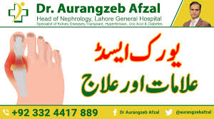 Sign, Symptoms and Treatment of Uric Acid in Urdu by Dr Aurangzeb Afzal