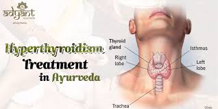 ayurveda treatment for hyperthyroidism
