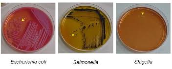 When xl agar is supplemented with sodium thiosulfate, ferric ammonium citrate, and sodium deoxycholate, it is then termed xld agar, and is. Salmonella Shigella Ss Agar Composition Principle Procedure And Results Learn Microbiology Online