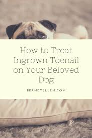 how to treat ingrown toenail on your