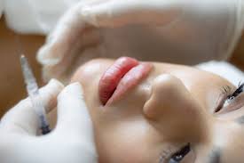 how much do dermal fillers cost canada