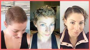 my tips for hair growth post chemo