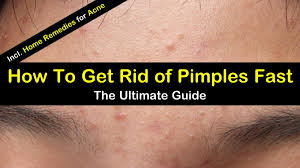 remes to get rid of pimples fast