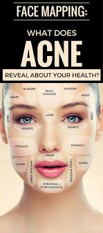 Face Mapping What Does Acne Reveal About Your Health
