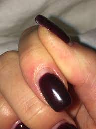We did not find results for: What Is This I Had A Light Yellow Spot On My Nail And I Picked It With A Tool And It Was Loose I Used My Nail Drill To Remove The Detached