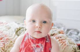 Once your hormones have become balanced again and also as your internal organs many women at this point notice a loss of thickness and that's because the density of your hair is normalizing since your hormones have become. Bald Baby It Is Normal For Babies To Lose Hair Parentinghealthybabies