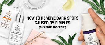 how to remove dark spots from pimples