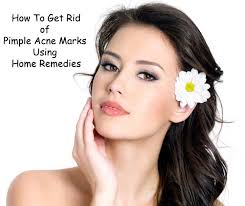 pimple acne marks using home remes