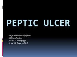 Pathology Of Peptic Ulcer