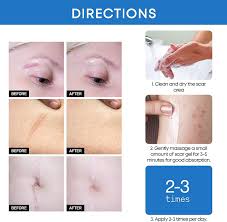 silicone scar gel for surgical scars