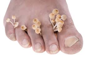 why are my toenails turning yellow