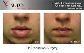 lip reduction surgery in australia