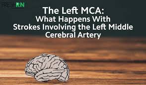 Some strokes, strokes or cerebral infarcts come suddenly without premonitory symptoms. Left Mca Strokes What Happens With Strokes Involving The Left Middle Cerebral Artery Freshrn