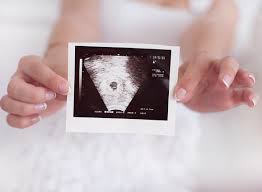 Zu beginn der fetalphase, die 1. 10 Ssw Ultraschallbild Mytoys Blog