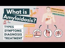what is amyloidosis symptoms