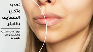enlarging the lips with fillers