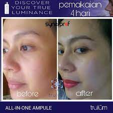 Trulum revolutionizing skincare industry, denpasar, indonesia. Trulum 5ml Krim Pemutih Wajah Bpom Shopee Indonesia