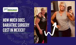 If you are severely overweight and are of high risk for serious health issues, this procedure can be great for you. Weight Loss Surgery Cost In Mexico Jet Medical Tourism
