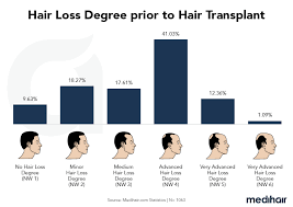 Hair growth chart after hair transplant. Hair Transplant Guide 2021 Costs Turkey Before After