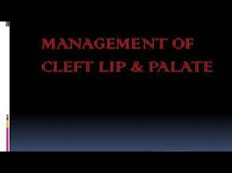 cleft lip and palate surgery you