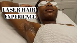 Some skin care tasks are more glamorous than others, but that doesn't make them any less important. Underarm Laser Hair Removal On Dark Skin Youtube