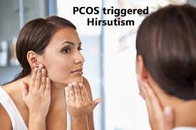 High testosterone in women can sometimes go beyond simple hirsutism and cause other symptoms to develop in a process called virilization. Managing Facial Hair With Pcos Treatments Tips Remedies