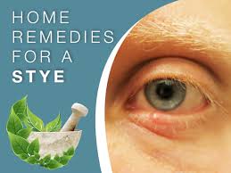 how to get rid of a stye safe and