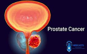 Make an appointment with your doctor if you have any persistent signs or symptoms that worry you. What Is Prostate Gland Cancer Causes Symptoms Diagnosis And Treatment