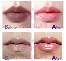 images?q=tbn:ANd9GcQqtc6OK1rWpIUL3eh1JCcQGdvaZU yxeCnbPNsPoh03UayvBcneQ - Dịch vụ xăm môi collagen ở tại tpHCM