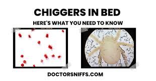 Chiggers In Bed Here S What You Need