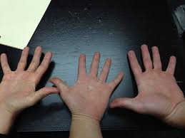 hand maintenance invictus fitness