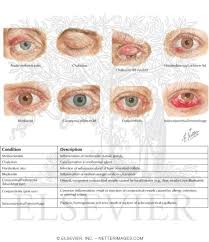 eyelid infections and conjunctival