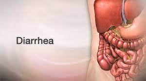 diarrhea overview information mount