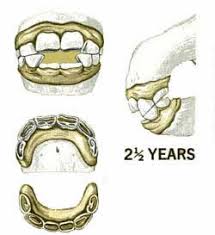 Horses Age From Teeth Growth Knowing The Signs Of Age