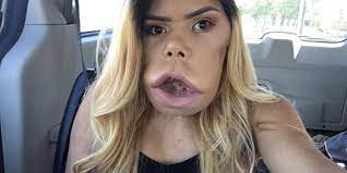 this beauty vlogger with cystic hygroma