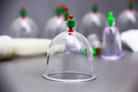 Cupping Therapy Al Hijama A Cure For Every Disease Pain