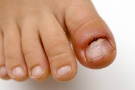 sharp pain in the big toe