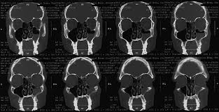 radiology images