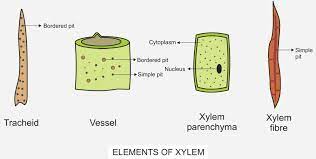 name the diffe elements of xylem