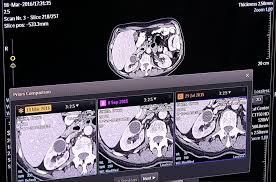 How Artificial Intelligence Will Change Medical Imaging