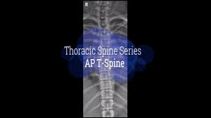 X Ray Positioning For Thoracic Spine