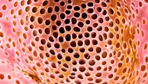 Does this image freak you out? You may suffer from trypophobia - Futurity