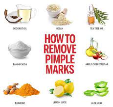 how to remove pimple marks 12 effective
