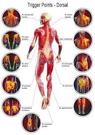 muscle spasm trigger points